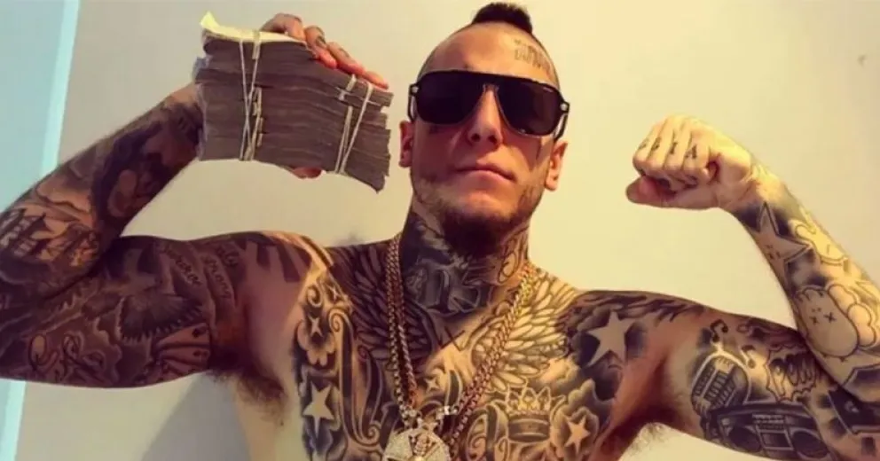 Alex Caniggia mostró el paso a paso de su cambio de rostro: mirá cómo le quedó