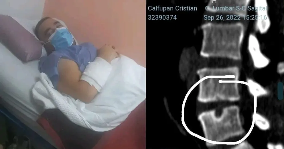 Dramática situación de un viedmense: “No puedo trabajar, no puedo hacer fuerza y tengo 5 hijos”