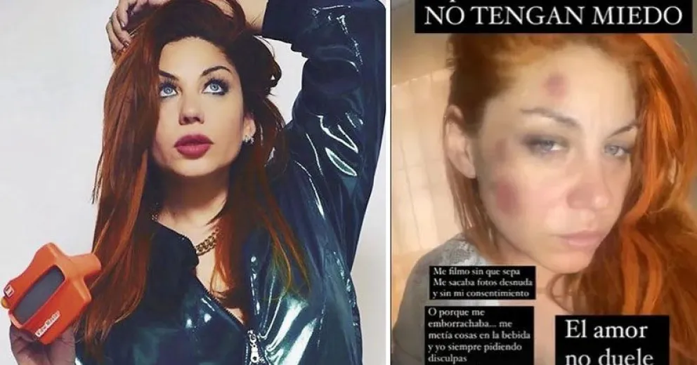 La denuncia por violencia de género de Lowrdes, ex Bandana