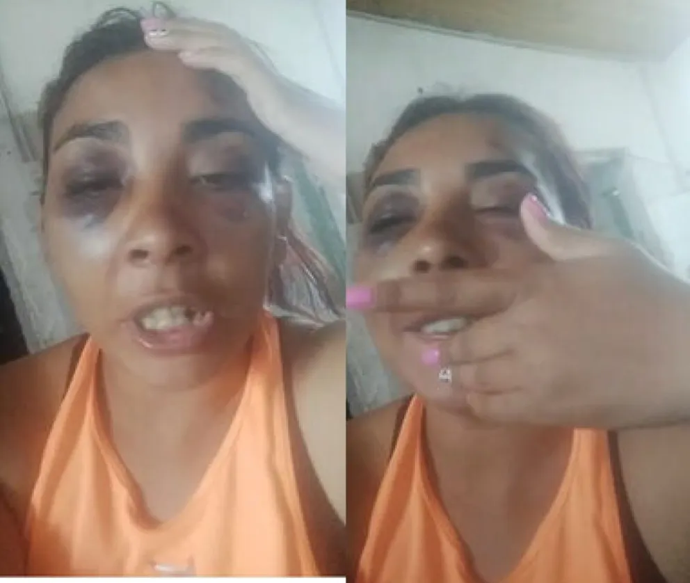 Escándalo en SAO: concejal pidió un aporte público para cubrir los gastos de la mujer que fue atacada por su esposa 