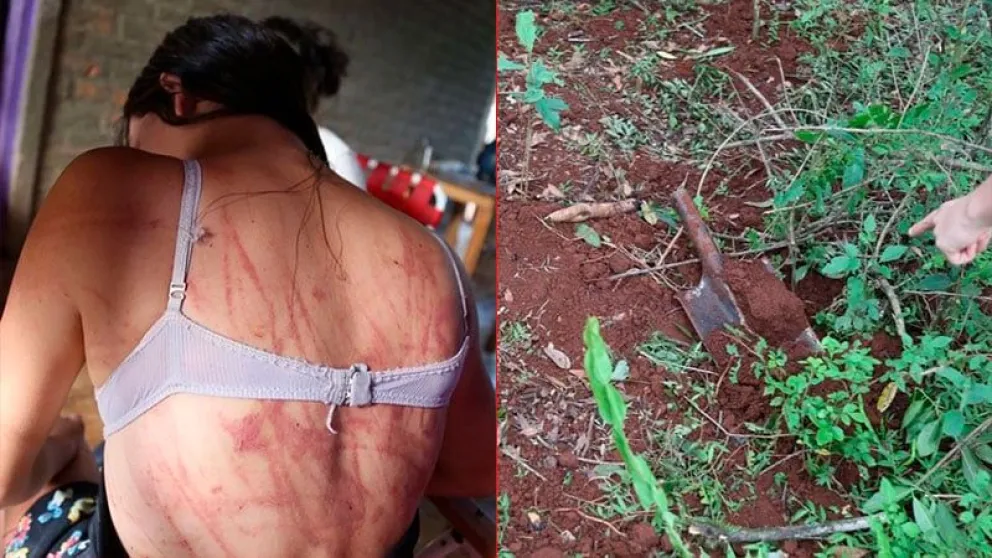 Intento de femicidio: secuestró, torturó a su novia y después la enterró viva