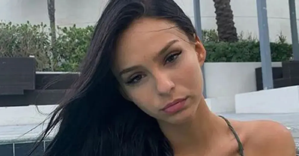 El fuerte retoque facial al que se sometió Juanita Tinelli