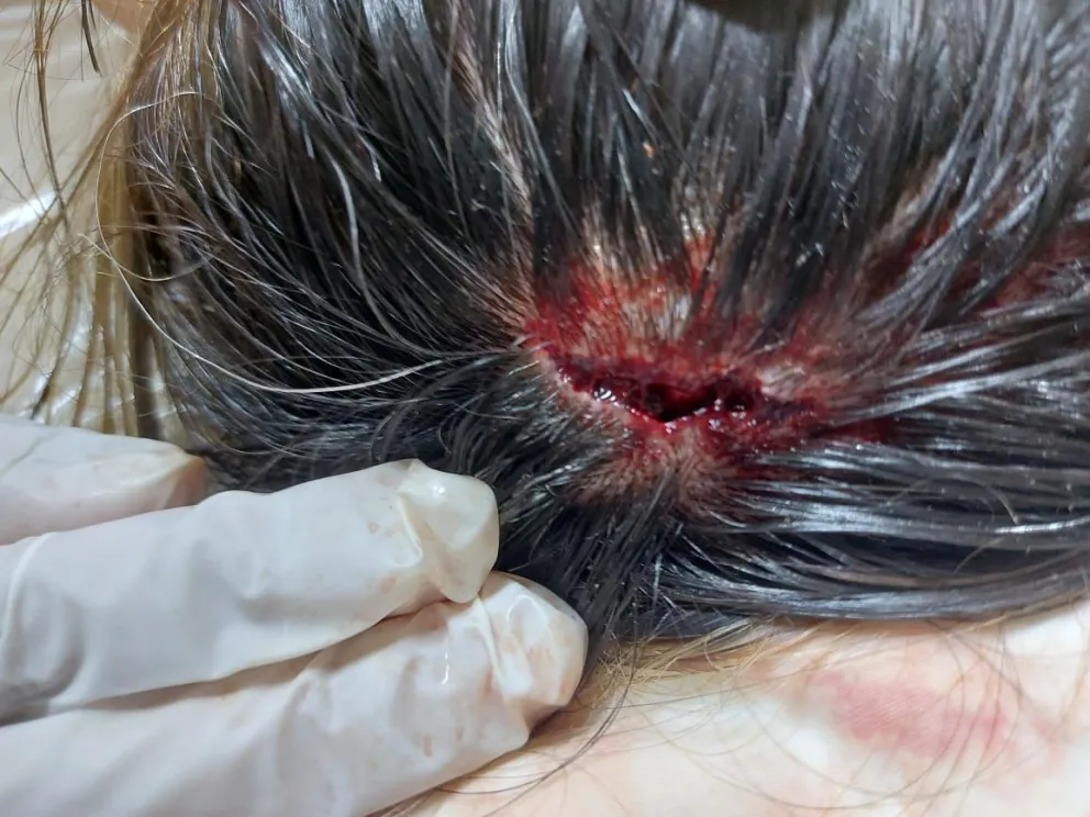 Hieren con un rebenque a una mujer, y ya hay una causa por violencia de género