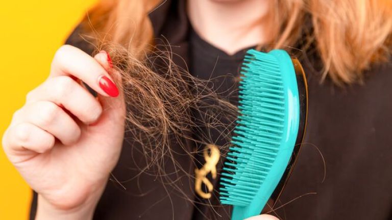Alopecia: cuáles son las causas de la caída del cabello y cómo evitarla