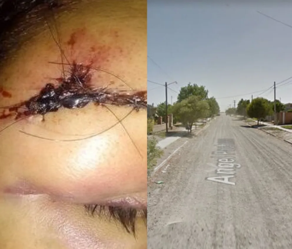 Una mujer denunció que fue golpeada en un bar clandestino de Patagones: “Fue un intento de homicidio”