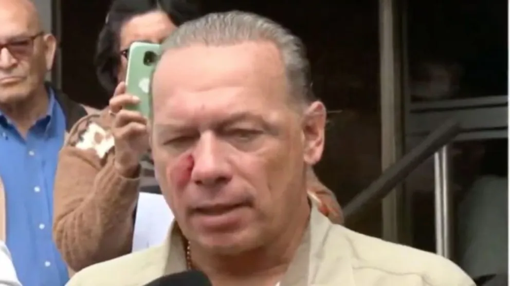 Berni anunció que no va a renunciar ni a denunciar a sus agresores