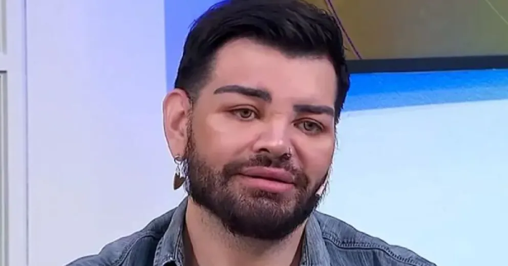 Mariano Fran relató su drama tras una cirugía en la cara con Aníbal Lotocki: "Me puso aceite y..."