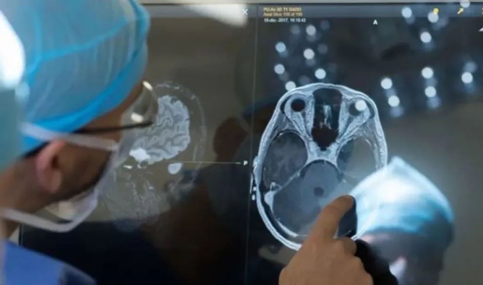 Increíble: un sistema de Inteligencia Artificial puede escanear la mente y leer los pensamientos