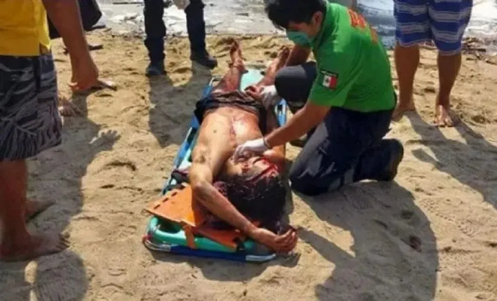 Turistas argentinos atacados por desconocido en una playa de Oaxaca: uno de ellos lucha por su vida y su familia pide ayuda 