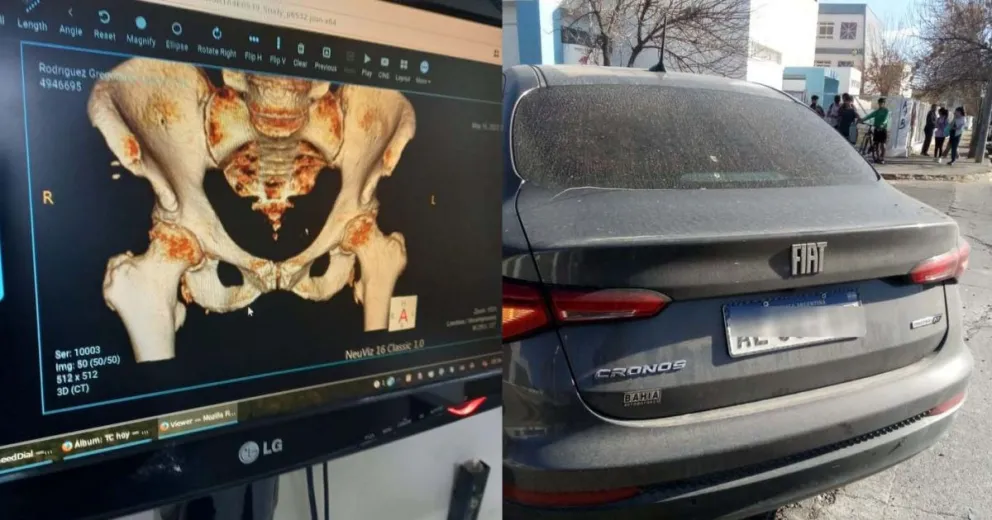 Atropellaron a su mamá, hizo una búsqueda por redes sociales y éste fue el desenlace