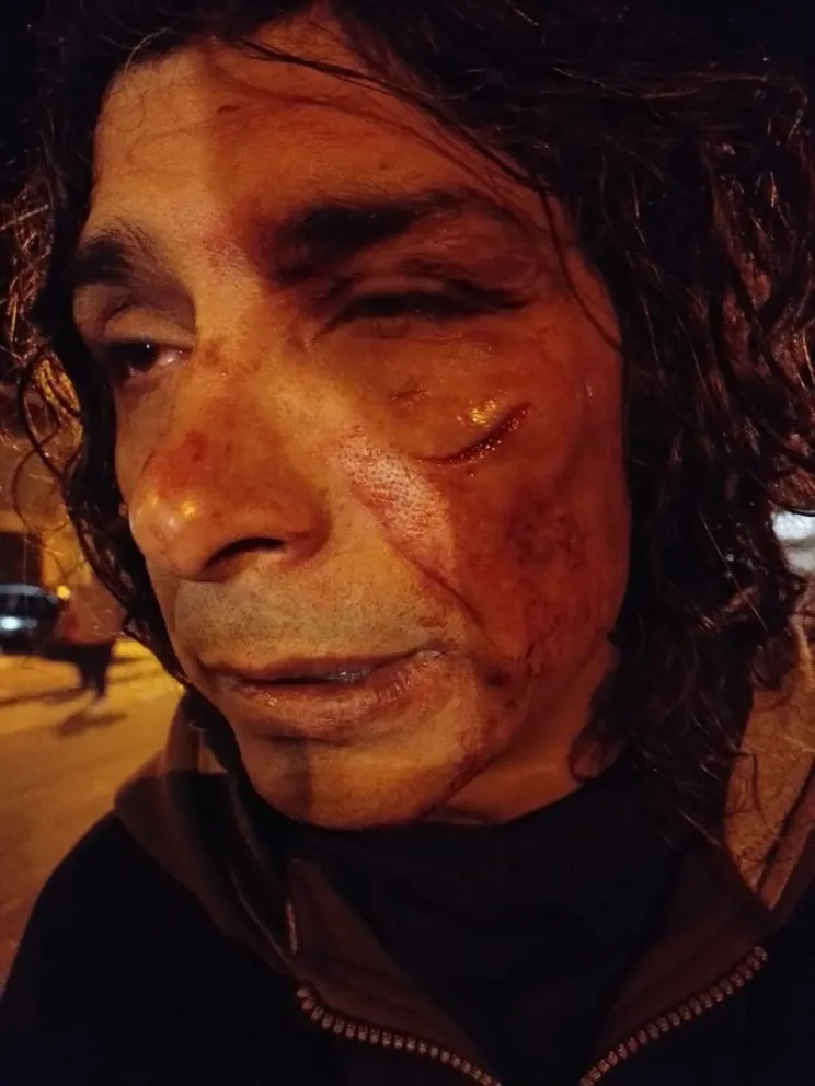 Una violenta trifulca entre músicos desnaturalizó un festival solidario